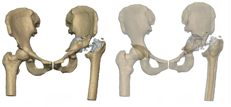 Preoperative imaging