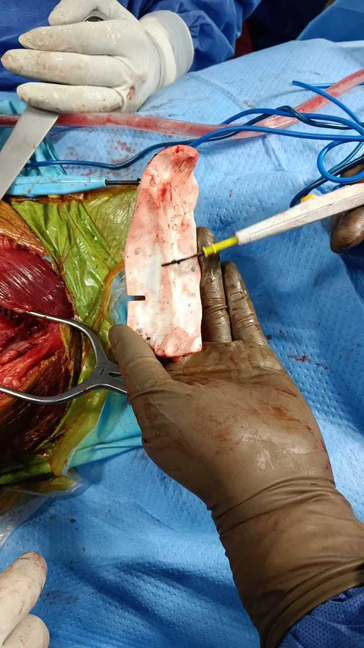 Postoperative recovery