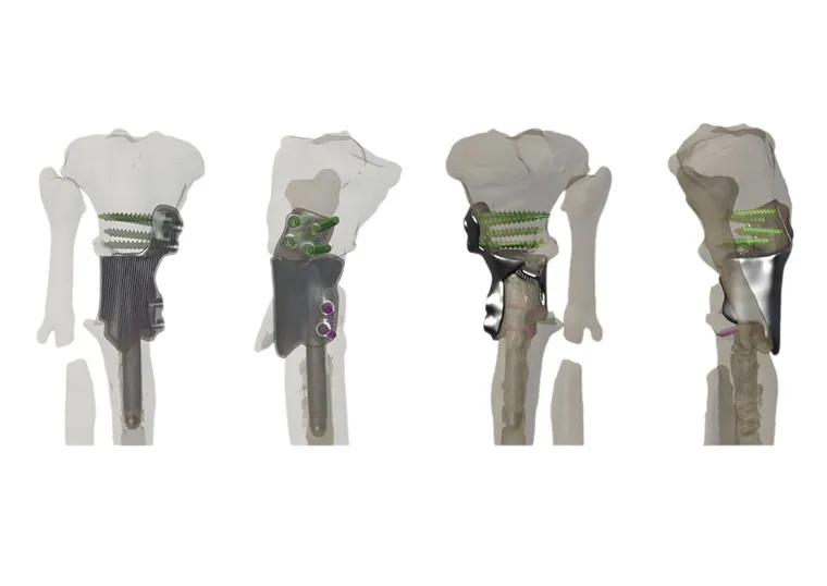 Implant design against the plan