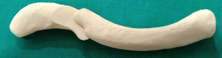 3D-printed clavicle models