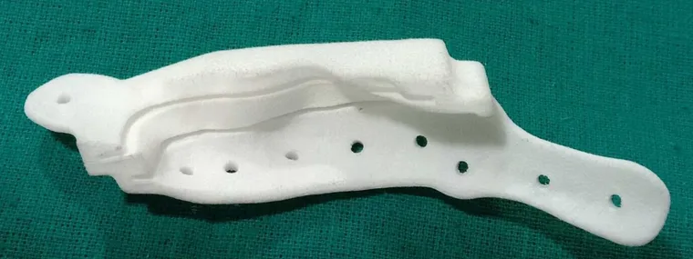 3D-printed resection guide