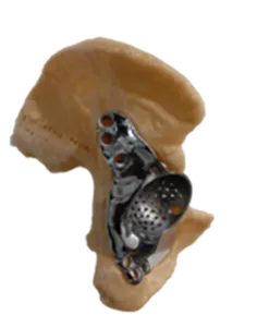 Preoperative condition