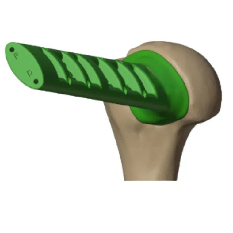 Guide seated on the humeral head