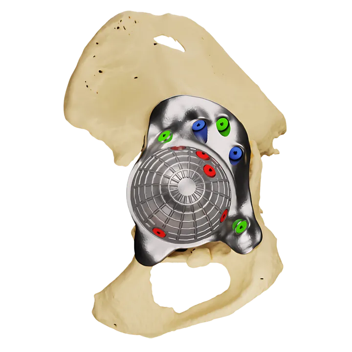 FTL flanged triflange acetabular cup