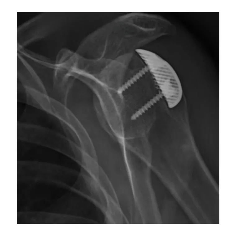 Postoperative imaging