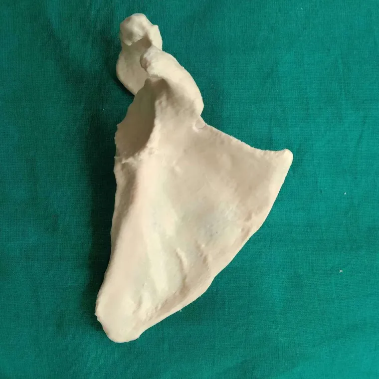 3D-printed scapula model