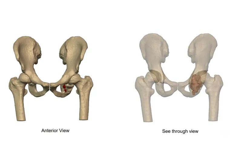 Preoperative imaging