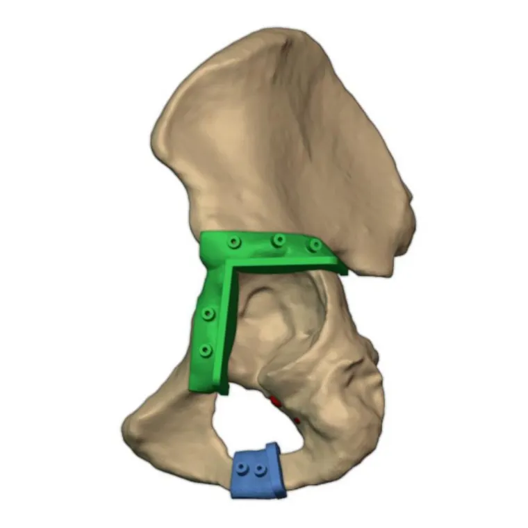 Resection jigs