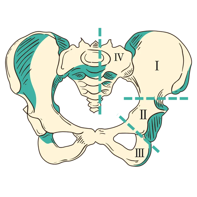 Tumour extent