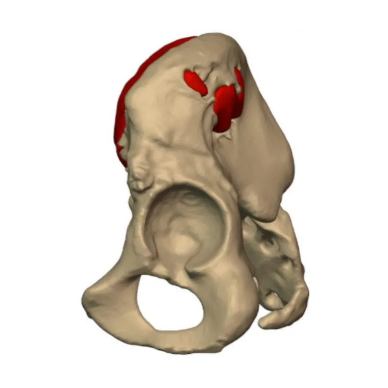 Segmented anatomy