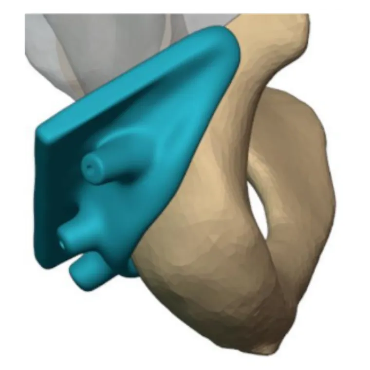 Planned resection planes