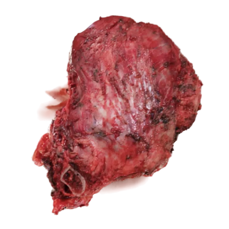 Osteotomy