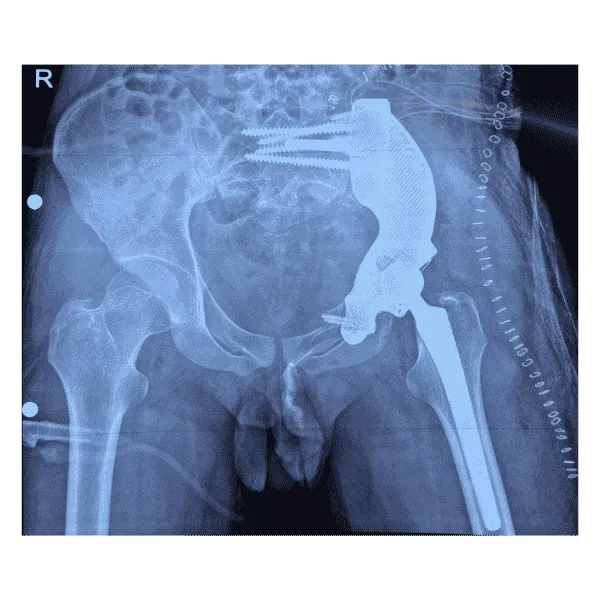 Postoperative imaging