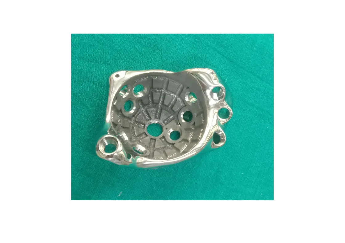 Patient-specific FTL cup for complex hip revision