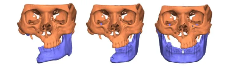 Mirrored mandible reference