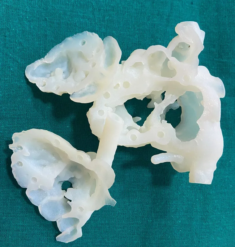 Printed paediatric heart model