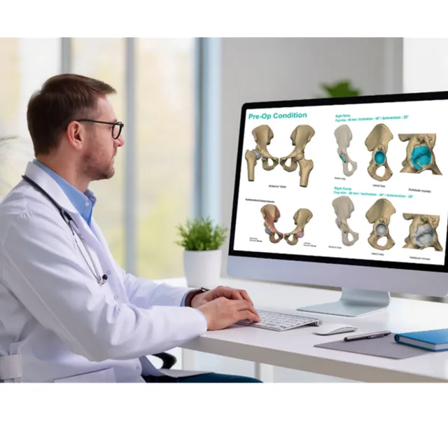 Virtual surgical planning session
