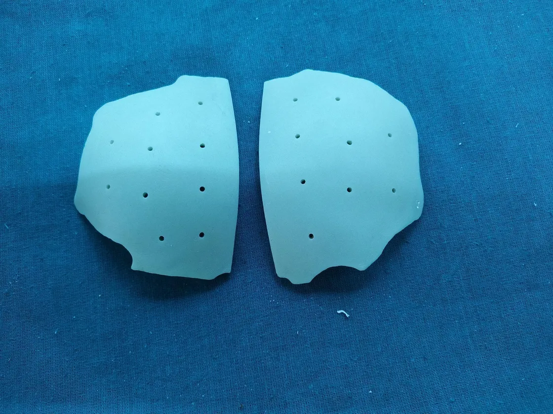 Customized two-part PMMA cranial plate for a frontal defect