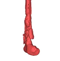 Assessment of the joint surfaces