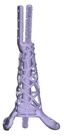 Cage-like implant with intramedullary rod