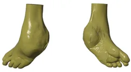 Pre-op soft tissue
