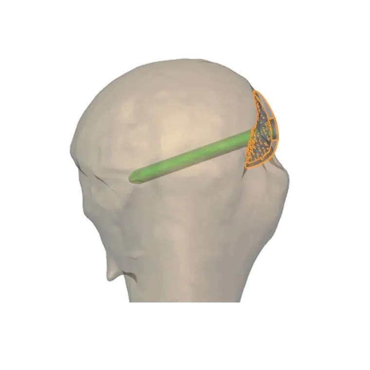 Reconstructed head curvature
