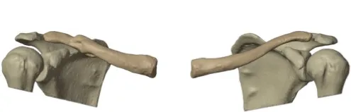 Pre-operative condition
