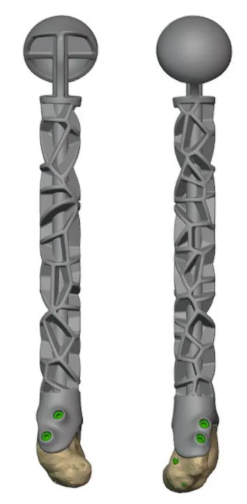 Implant design view