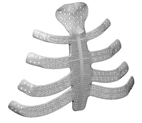 Single-component sternum-ribs implant