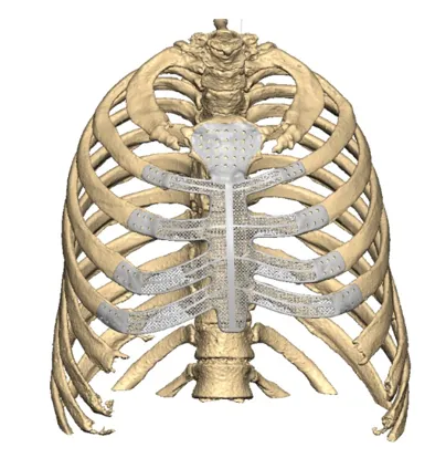 Sternal model and plan