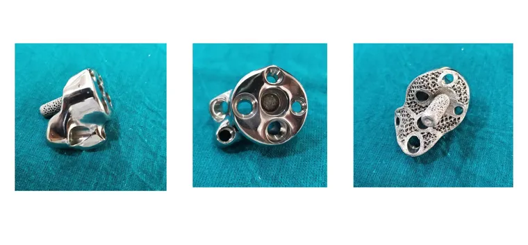 ReGlen implant for glenoid reconstruction