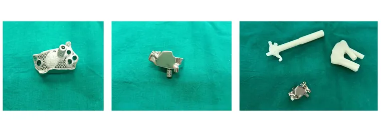Patient-specific surgical jigs