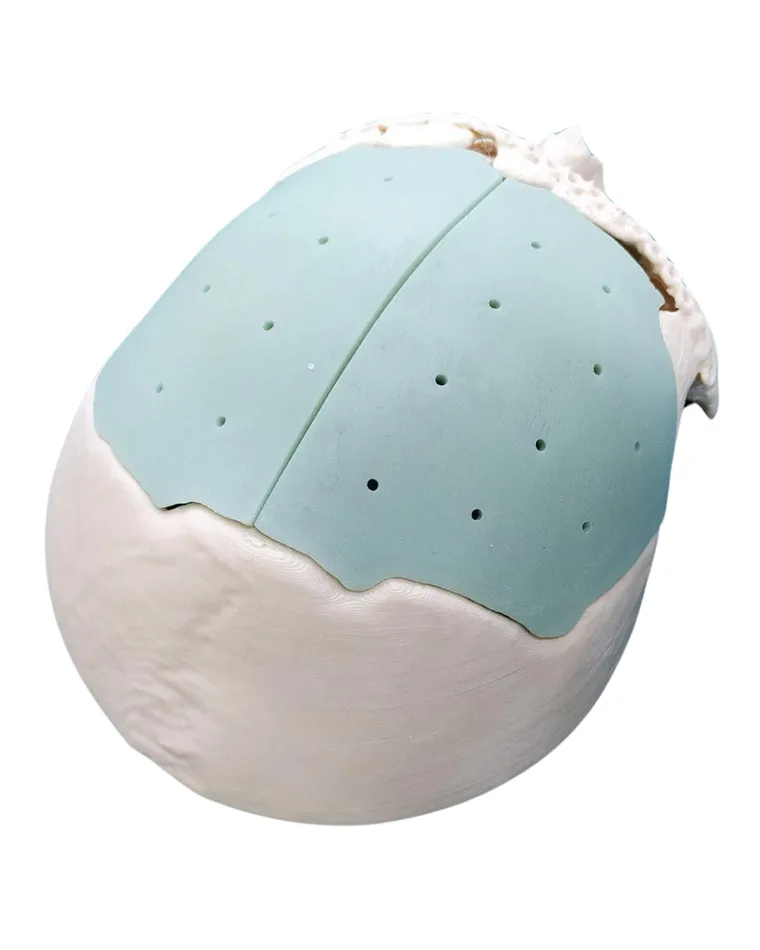 Two-part cranial plate design