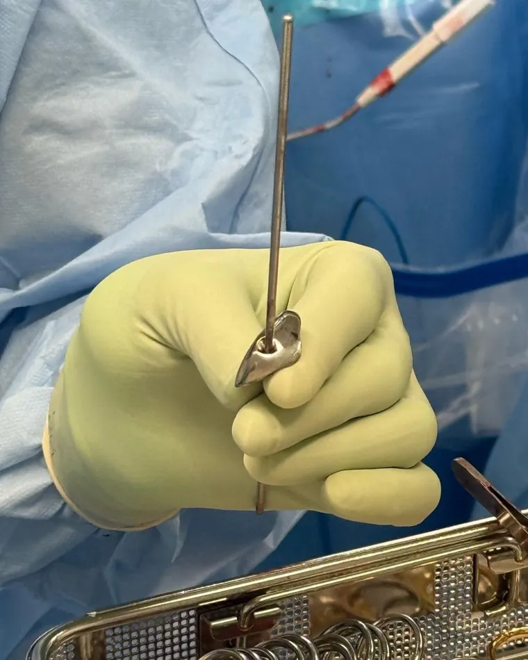 Implant detail