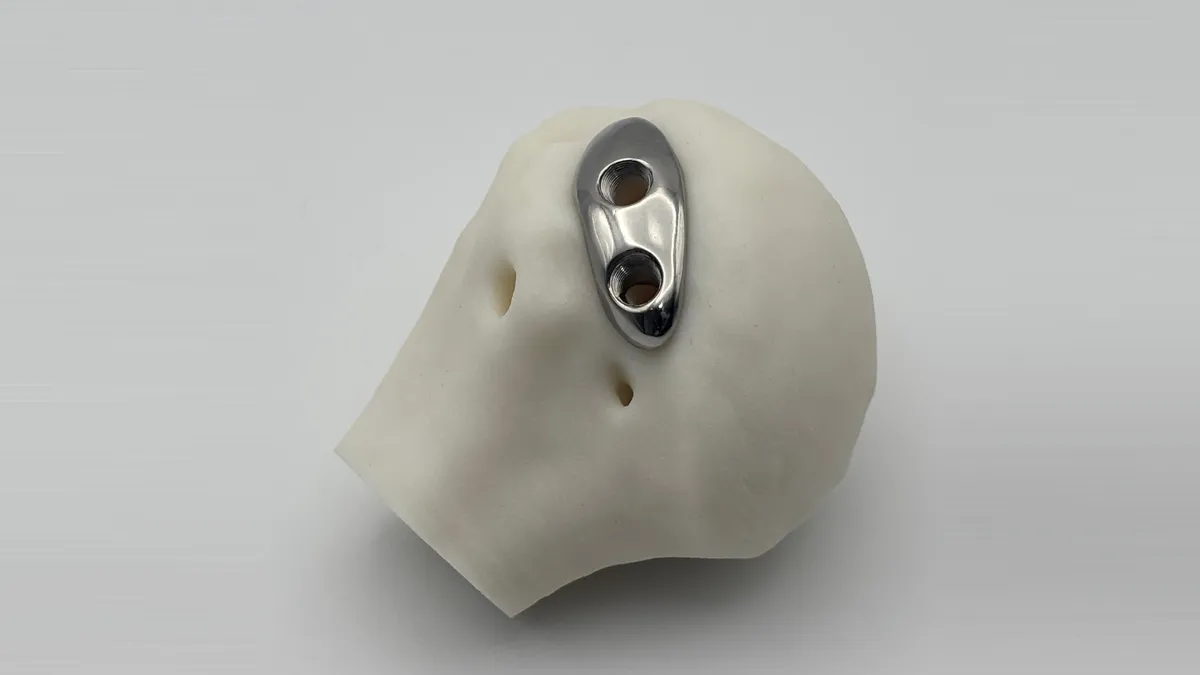 ArthroDome patient-specific implant