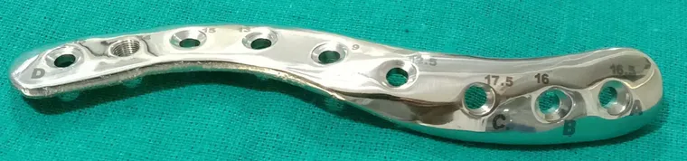 Patient-specific clavicle implant plate