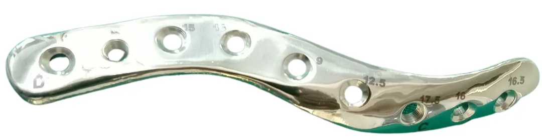 Patient-specific clavicle implant plate