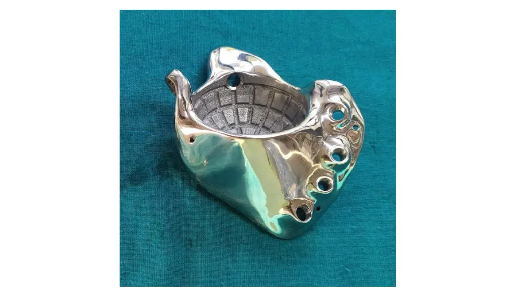 Custom FTL cup for pelvic discontinuity