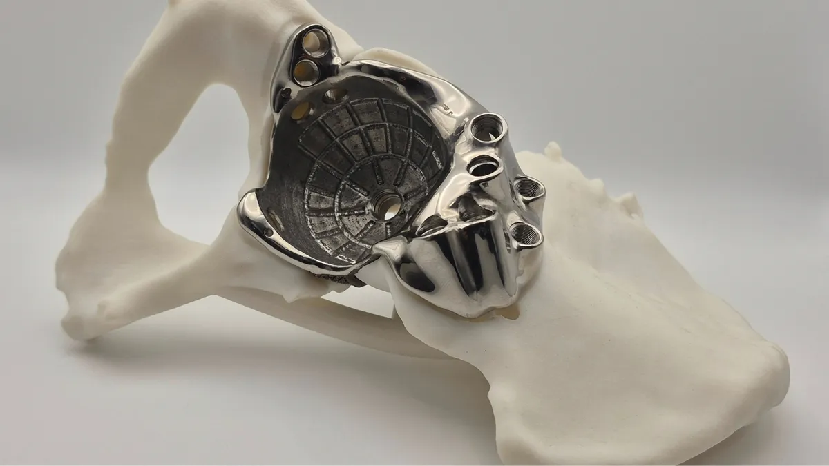 FTL Cup patient-specific implant