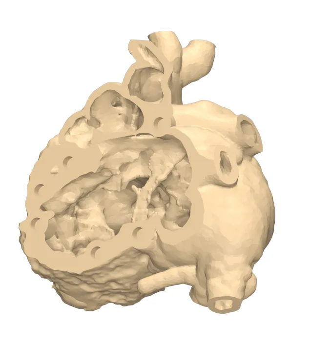 Segmented 3D heart model