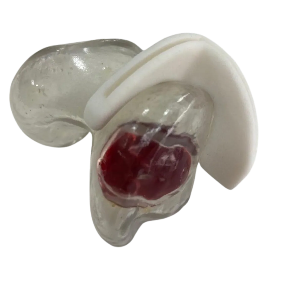 Patient-specific cutting jig fitted to a 3D-printed distal femur model
