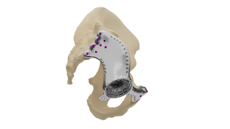 Postoperative imaging