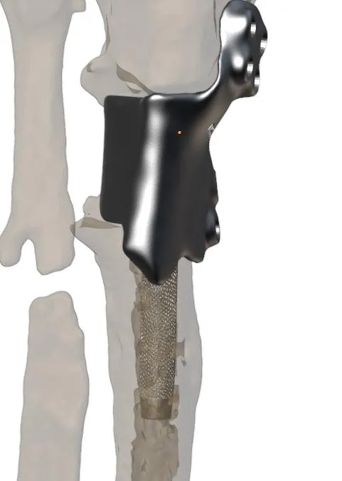 Realigned tibia