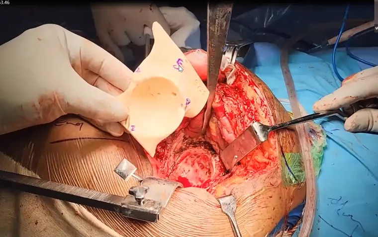 Intra-operative 3D model usage
