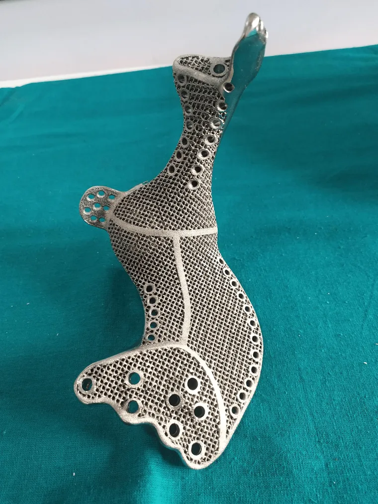 Implant design, anterior view