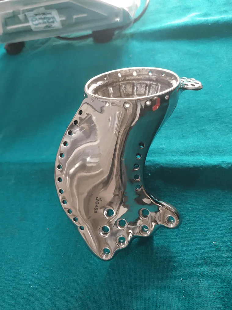 Locking screw fixation plan