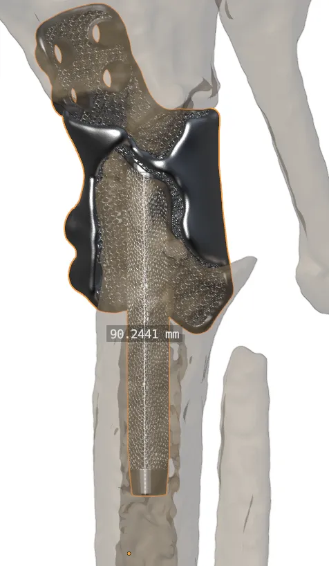 Postoperative imaging