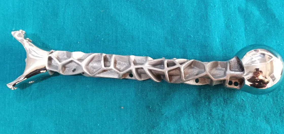 Custom titanium humerus prosthesis