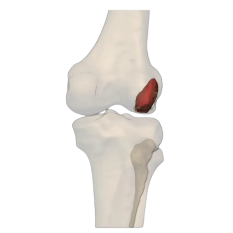 CT-based 3D reconstruction, anterior view
