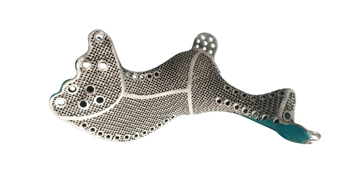 Custom 3D-printed hemipelvis implant